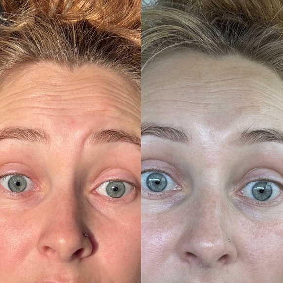 NATURE’S BOTOX IN A BOTTLE - Picture 8 of 9